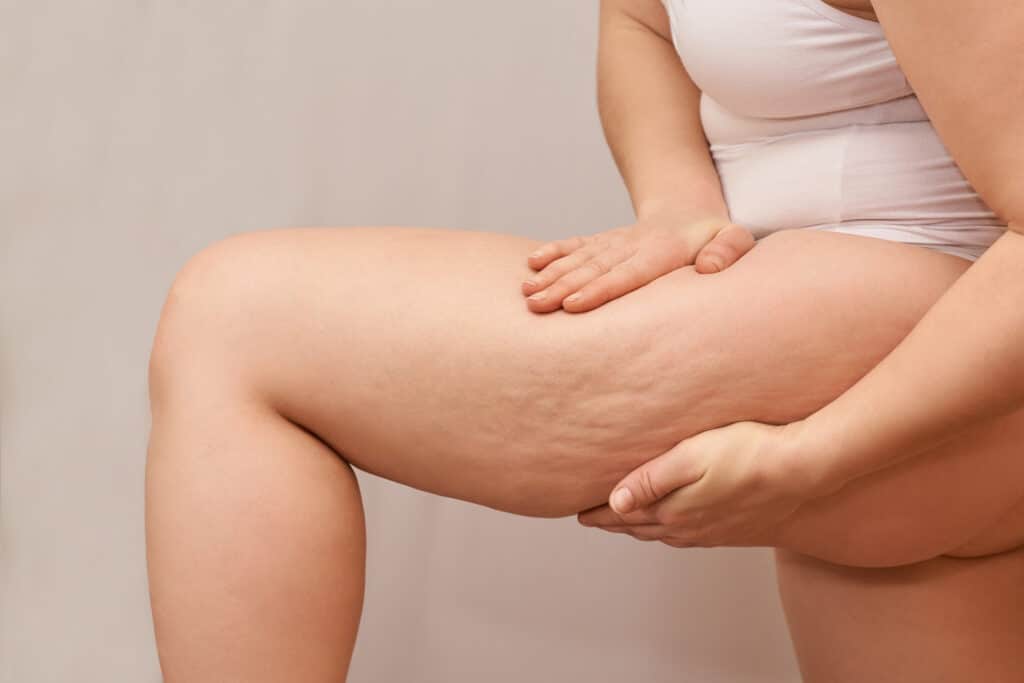 iStock 1225546416